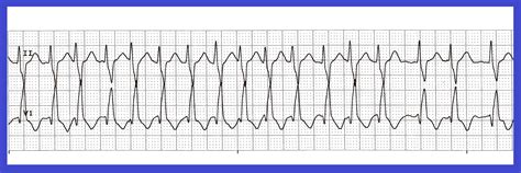 Image result for Solving Routine ND Non-Routine