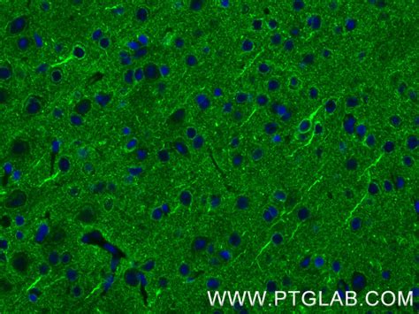 PLTP antibody (84592-1-RR) | Proteintech