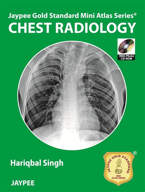 Buy Jaypee Gold Standard Mini Atlas Series Chest Radiology Book Online ...