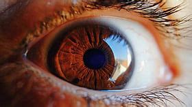 Doctors Report Rise In Myopia Among Youth, Urge ActionTto Prevent ...