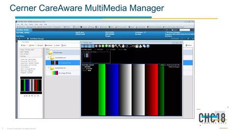 Integrating Cerner Millennium w/Stryker surgical imaging system | PPTX ...