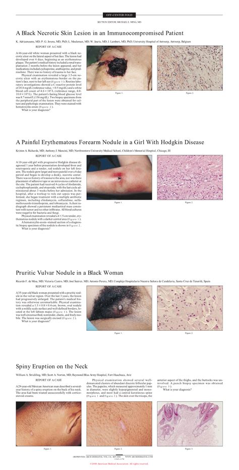 Pruritic Vulvar Nodule in a Black Woman | JAMA Dermatology | The JAMA Network