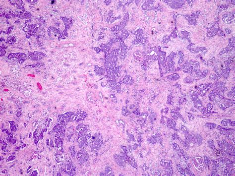 Renal Medulla Histology
