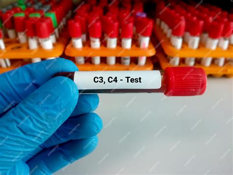 Premium Photo | Blood sample for c3 and c4 complement testing with ...