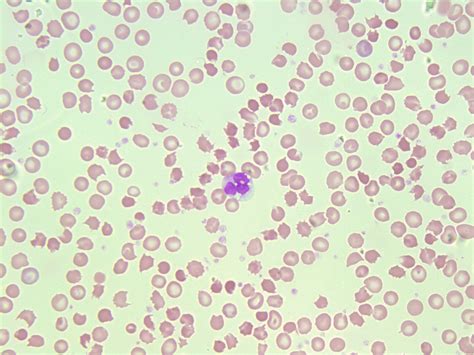Image result for Monocyte