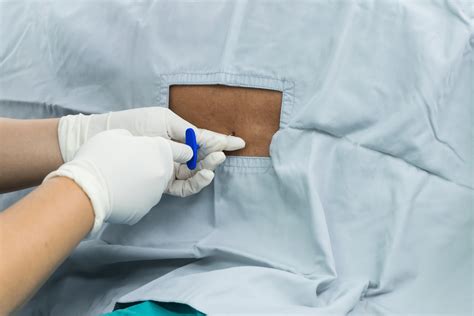 Nerve Block Injection 的图像结果