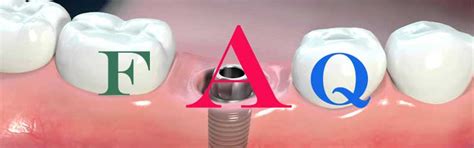 TMJ Disorder FAQ | Smile Centre India FAQ