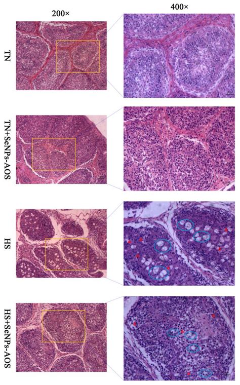 Biogenic Selenium Nanoparticles Synthesized with Alginate ...