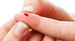 New paper-based diabetes test for developing countries | News | Zee News