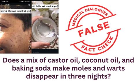 Fact Check: Does a mix of castor oil, coconut oil, and baking soda make ...