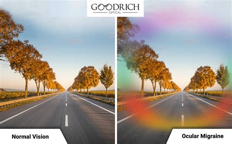 Blurry Eyes And Headache