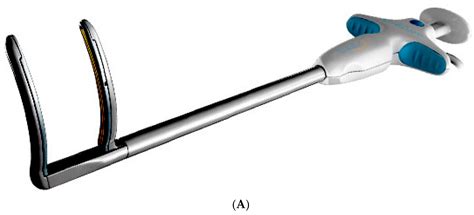 A Hybrid Minimally Invasive Atrial Fibrillation Ablation Procedure ...