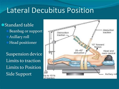 Shoulder Arthroscopy positioning and preparation | PPTX