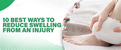10 Best Ways to Reduce Swelling from an Injury