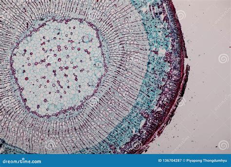 Dicot Root Microscope Anat0919