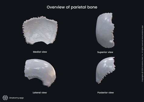Parietal Bone Examples
