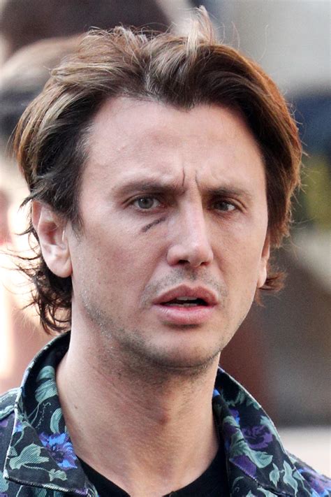 Jonathan Cheban Face Surgery