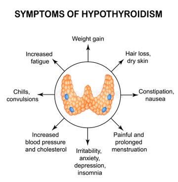 Image result for hyperthyroidism