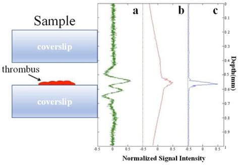 Resolution Enhancement Strategies in Photoacoustic Microscopy: A ...