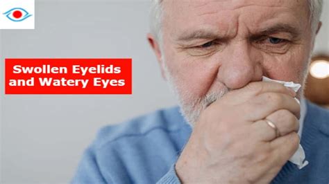 Swollen Eyelid and Watery Eyes: Causes and Treatment - Swollen Eyelid
