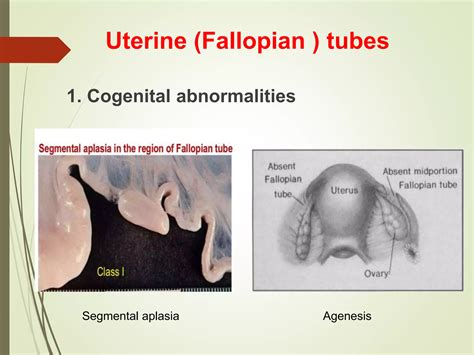 Image result for Female Reproductive System Disorders