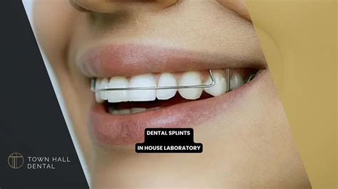 Dental Splints In-House Laboratory | Town Hall Dental Clinic