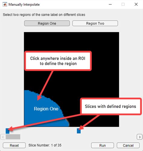 Image result for Volume Segmenter MATLAB Tutorial