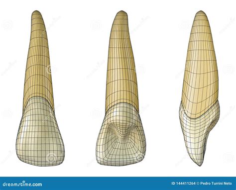 Maxillary Lateral Incisor Tooth in the Vestibular, Palatal and Lateral ...