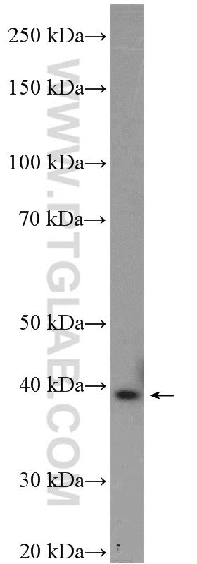 AMPK Beta 1 antibody (26907-1-AP) | Proteintech