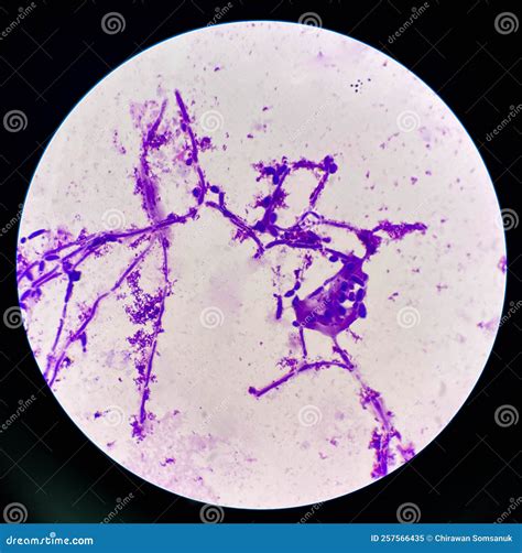 Budding Yeast Cells With Pseudohyphae In Urine Sample On Wright Gimsa ...