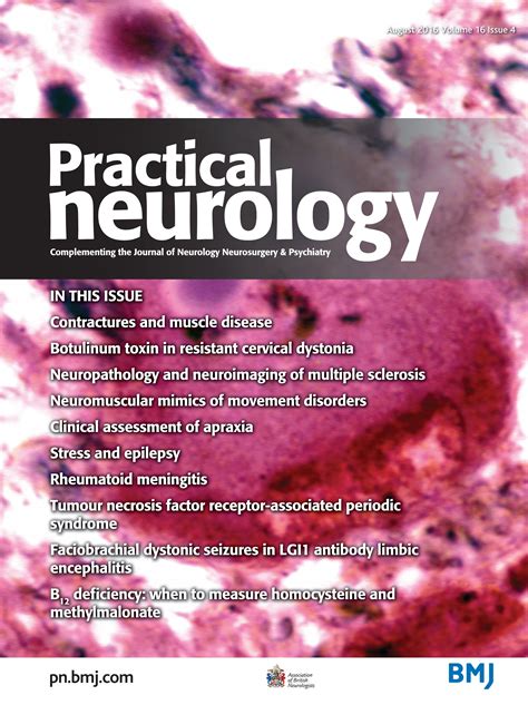 Image result for Apraxia Example