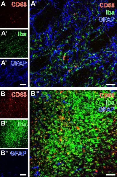 Image result for Neocortex Disorders
