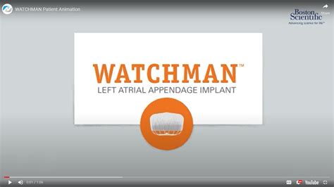 WATCHMAN procedure