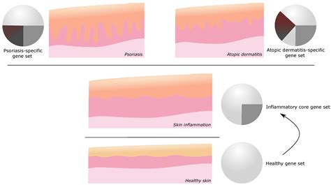 Review—Current Concepts in Inflammatory Skin Diseases Evolved by ...