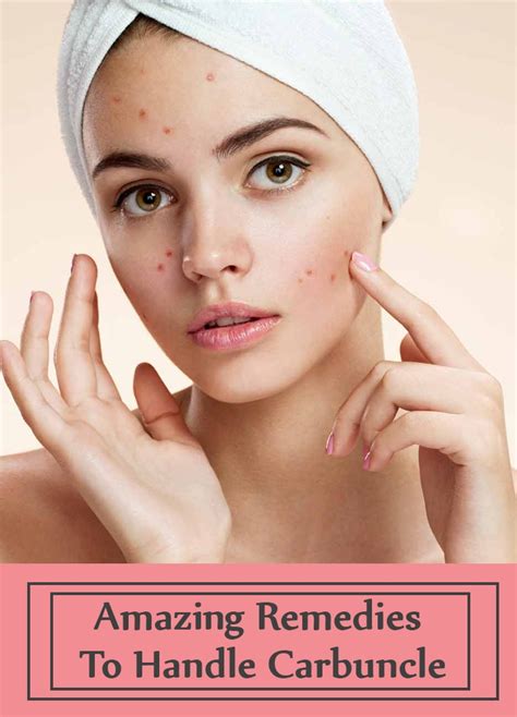 Image result for Removing Carbuncle