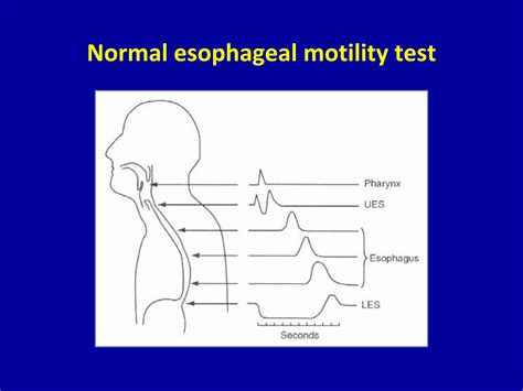 Classification of esophageal motility disorders | PPTX
