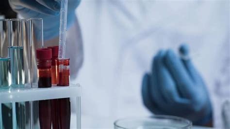 必应检验科 的图像结果