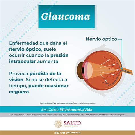 Que Es Glaucoma
