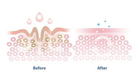 Copper Peptide Supplier for Skincare | Flychem's B2B Guide