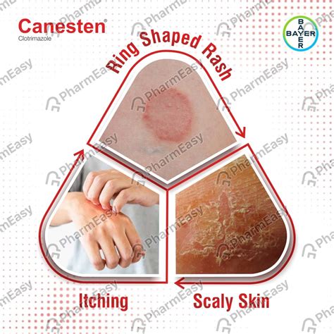 Canesten 10 MG Skin Solution (30): Uses, Side Effects, Price & Dosage ...