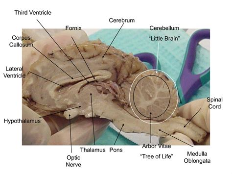 Sheep brain gross anatomy | PDF