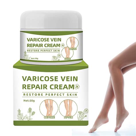 Buy ZHUXIAO CDBGVDB VeinsRepair Varicose Treatment Cream, Spider Leg ...