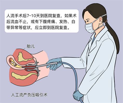 人工流产手术流程是怎样的，七张图，讲清整个过程_女性