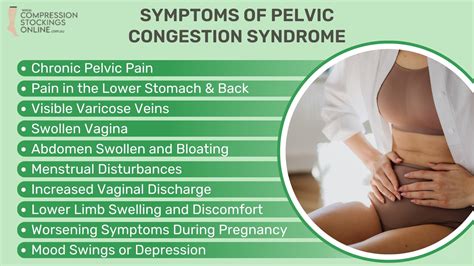 Pelvic Congestion Syndrome