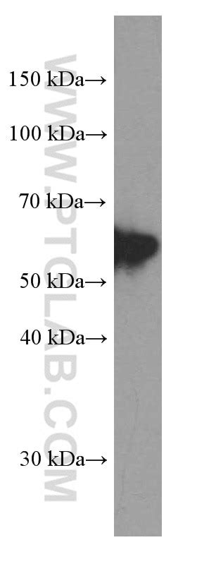 Peripherin antibody (66317-1-Ig) | Proteintech