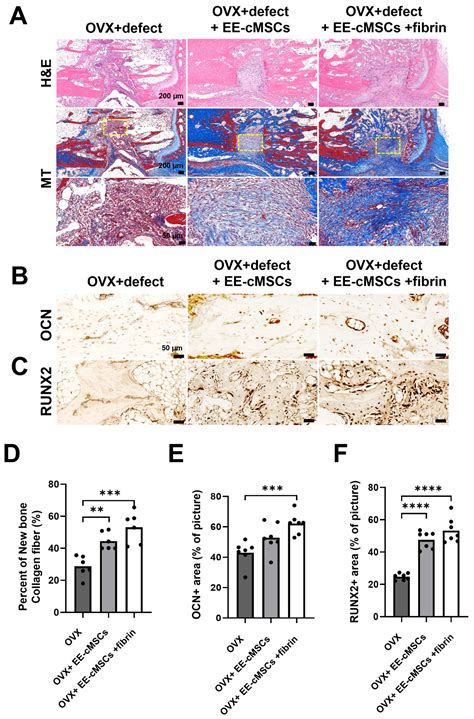 Promotion of Bone Formation in a Rat Osteoporotic Vertebral Body Defect ...