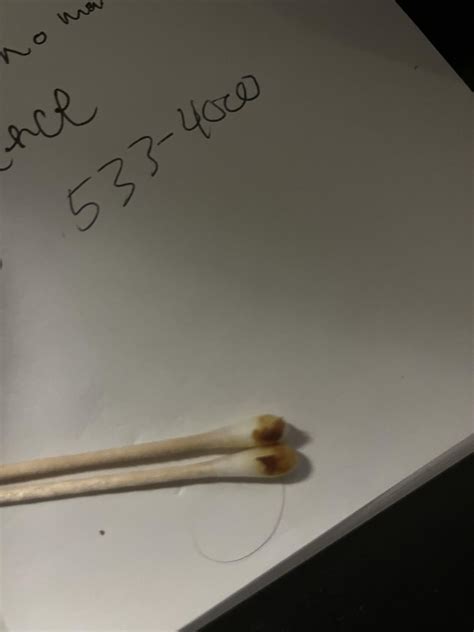 Dark Ear Wax : r/earwax