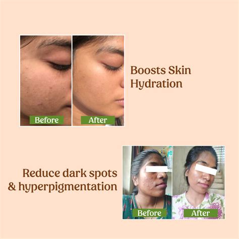 Buy Milk Drops Face Brightening Serum Online for Dull & Glowing Skin