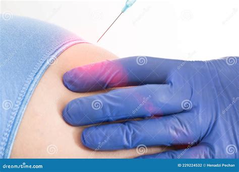 Local Anaesthetic Injection Back Pain at Eula Seay blog