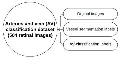 Image result for Channel AV Classification